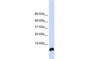 WB Suggested Anti-GLRX Antibody Titration: 0. (Glutaredoxin 1 抗体  (N-Term))