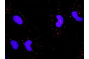 Proximity Ligation Assay (PLA) image for anti-Neurotrophic Tyrosine Kinase, Receptor, Type 2 (NTRK2) (AA 1-477) antibody (ABIN518450)