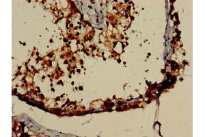 Immunohistochemistry of paraffin-embedded human testis tissue using ABIN7161885 at dilution of 1:100 (PPP1R9A 抗体  (AA 1-243))