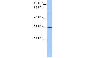 WB Suggested Anti-HUS1B Antibody Titration: 0. (HUS1B 抗体  (N-Term))