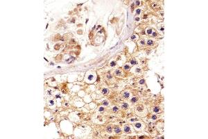 Immunohistochemical analysis of paraffin-embedded H. (EPH Receptor A4 抗体  (AA 383-417))