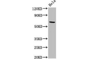 Western Blot Positive WB detected in: Hela whole cell lysate All lanes: ACADVL antibody at 2 μg/mL Secondary Goat polyclonal to rabbit IgG at 1/50000 dilution Predicted band size: 71, 69, 73 kDa Observed band size: 71 kDa (ACADVL 抗体  (AA 403-497))