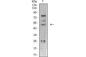 Western Blotting (WB) image for anti-Transcription Factor AP-2 gamma (Activating Enhancer Binding Protein 2 Gamma) (TFAP2C) (AA 341-450) antibody (ABIN5611194)