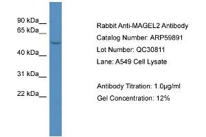 WB Suggested Anti-MAGEL2  Antibody Titration: 0. (MAGE-Like 2 抗体  (N-Term))