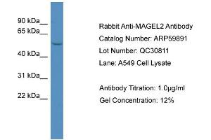 WB Suggested Anti-MAGEL2  Antibody Titration: 0.