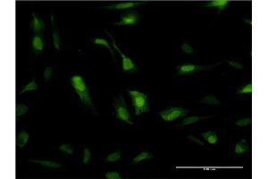Immunofluorescence of monoclonal antibody to SOD1 on HeLa cell. (SOD1 抗体  (AA 1-154))
