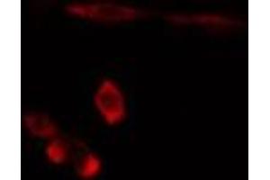 ABIN6275892 staining  Hela cells by IF/ICC. (FTH1 抗体  (C-Term))