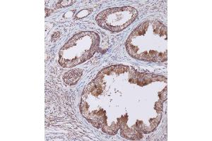 Immunohistochemical analysis of (ABIN656404 and ABIN2845698) on paraffin-embedded Human prostate tissue. (WFDC1 抗体  (C-Term))