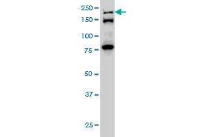 ESPL1 monoclonal antibody (M01), clone 6H6 Western Blot analysis of ESPL1 expression in Hela S3 NE . (Separase 抗体  (AA 586-701))