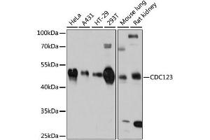 Western blot analysis of extracts of various cell lines, using CDC123 antibody (ABIN4903209) at 1:3000 dilution. (CDC123 抗体)
