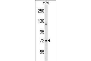 Western blot analysis in Y79 cell line lysates (35ug/lane). (NCDN 抗体  (N-Term))