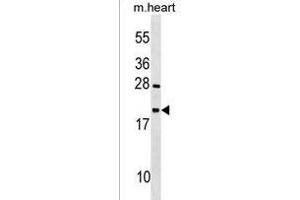 TEX12 Antibody (Center) (ABIN1538318 and ABIN2850043) western blot analysis in mouse heart tissue lysates (35 μg/lane). (TEX12 抗体  (AA 34-63))