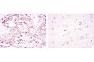 Immunohistochemistry (IHC) image for anti-Protein Kinase, AMP-Activated, alpha 1 Catalytic Subunit (PRKAA1) antibody (ABIN969364)