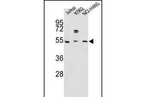 Western blot analysis of OA4 Antibody (N-term) 7591a in Jurkat, K562, NCI- cell line lysates (35 μg/lane).