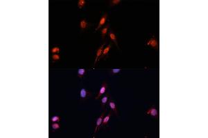 Immunofluorescence analysis of HeLa cells using Smad5 Polyclonal Antibody (ABIN6128714, ABIN6148090, ABIN6148091 and ABIN6218232) at dilution of 1:100 (40x lens).