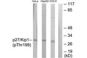 Western blot analysis of extracts from HeLa cells, HepG2 cells and COLO cells, using p27 Kip1 (Phospho-Thr198) Antibody. (CDKN1B 抗体  (pThr198))