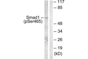 Western Blotting (WB) image for anti-SMAD, Mothers Against DPP Homolog 1 (SMAD1) (pSer465) antibody (ABIN1847221) (SMAD1 抗体  (pSer465))