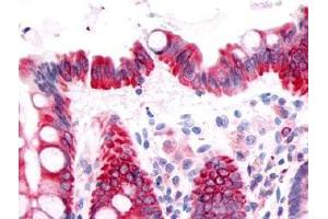 Immunohistochemistry (IHC) image for anti-Prostaglandin D2 Receptor (PTGDR) (Extracellular Domain) antibody (ABIN122373)