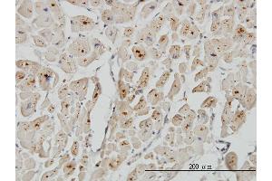 Immunoperoxidase of monoclonal antibody to ASAH1 on formalin-fixed paraffin-embedded human heart. (ASAH1 抗体  (AA 25-124))