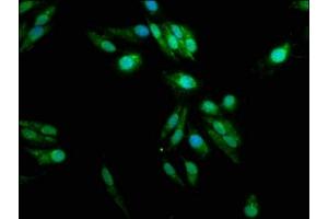 Immunofluorescence staining of Hela cells with ABIN7166389 at 1:100, counter-stained with DAPI. (PADI2 抗体  (AA 1-665))