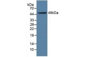 Detection of LILRB4 in Rat Adrenal Gland Tissue using Polyclonal Antibody to Leukocyte Immunoglobulin Like Receptor Subfamily B, Member 4 (LILRB4)