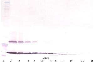 Western Blot (Unreduced) using TSLP antibody (Thymic Stromal Lymphopoietin 抗体)