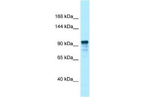 Western Blotting (WB) image for anti-Unc-13 Homolog D (UNC13D) (C-Term) antibody (ABIN2789769) (UNC13D 抗体  (C-Term))