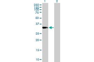 Western Blot analysis of PRKRA expression in transfected 293T cell line by PRKRA MaxPab polyclonal antibody. (PRKRA 抗体  (AA 1-313))