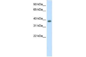 WB Suggested Anti-NEUROD2 Antibody Titration:  0. (NEUROD2 抗体  (C-Term))