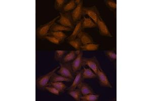 Immunofluorescence analysis of U-2 OS cells using 43711 antibody (ABIN7270204) at dilution of 1:100. (Septin 3 抗体  (AA 179-358))