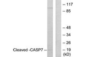 Western blot analysis of extracts from Jurkat cells, treated with Etoposide 25uM 24h, using Caspase 7 (Cleaved-Asp198) Antibody. (Caspase 7 抗体  (Cleaved-Asp198))