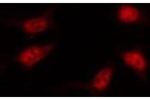 ABIN6267371 staining HT29 by IF/ICC. (Vitamin D Receptor 抗体  (pSer208))