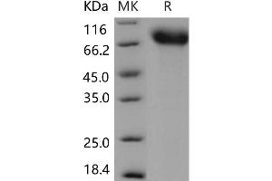 Western Blotting (WB) image for Neurotrophic Tyrosine Kinase, Receptor, Type 1 (NTRK1) (Active) protein (His tag) (ABIN7320045) (TRKA Protein (His tag))