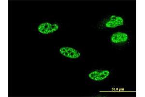 Immunofluorescence of monoclonal antibody to NFKB1 on HeLa cell. (NFKB1 抗体  (AA 860-969))