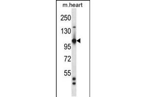 Western blot analysis in mouse heart tissue lysates (35ug/lane). (TIE1 抗体  (AA 361-389))