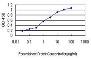 Detection limit for recombinant GST tagged GUCY2D is approximately 0. (GUCY2D 抗体  (AA 521-630))