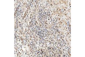 IHC analysis of SNRNP27 using anti-SNRNP27 antibody (ABIN7599614).