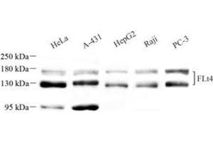Western blot analysis of VEGF Receptor 3 (ABIN7076194) at dilution of 1: 1000 (Vegf Receptor 3 抗体)