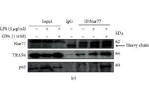 Western Blotting (WB) image for anti-Sequestosome 1 (SQSTM1) (AA 1-440) antibody (ABIN6148419)