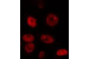 ABIN6274347 staining HepG2 cells by IF/ICC. (DYRK1A 抗体  (N-Term))