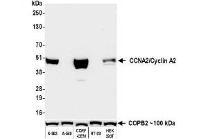 Western Blotting (WB) image for anti-Cyclin A2 (CCNA2) (C-Term) antibody (ABIN7795812)