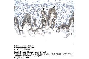Immunohistochemistry (IHC) image for anti-Prohibitin (PHB) (C-Term) antibody (ABIN2777606)