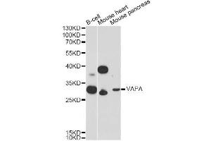 Western blot analysis of extracts of various cell lines, using VAPA Antibody. (VAPA 抗体)