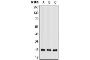 Western blot analysis of IL-28A expression in HEK293T (A), Raw264. (IL28A 抗体  (Center))