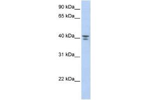GNA12 antibody used at 1 ug/ml to detect target protein. (GNA12 抗体)