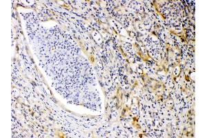 Immunohistochemistry (IHC) image for anti-Protein Kinase, CAMP-Dependent, Regulatory, Type I, alpha (Tissue Specific Extinguisher 1) (PRKAR1A) (AA 2-81) antibody (ABIN5518788)