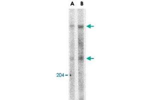Western blot analysis of ATM in Daudi whole cell lysate with ATM polyclonal antibody  at (A) 1 and (B) 2 ug/mL . (ATM 抗体  (C-Term))
