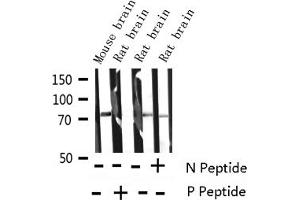Western blot analysis of Phospho-Synapsin (Ser9) expression in various lysates (SYN1 抗体  (pSer9))