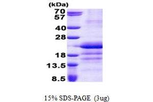 SDS-PAGE (SDS) image for Glutamyl-tRNA Amidotransferase, Subunit C (GATC) (AA 1-136) protein (His tag) (ABIN6387232) (GATC Protein (AA 1-136) (His tag))
