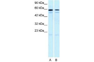WB Suggested Anti-HTR2C  Antibody Titration: 5. (HTR2C 抗体  (N-Term))